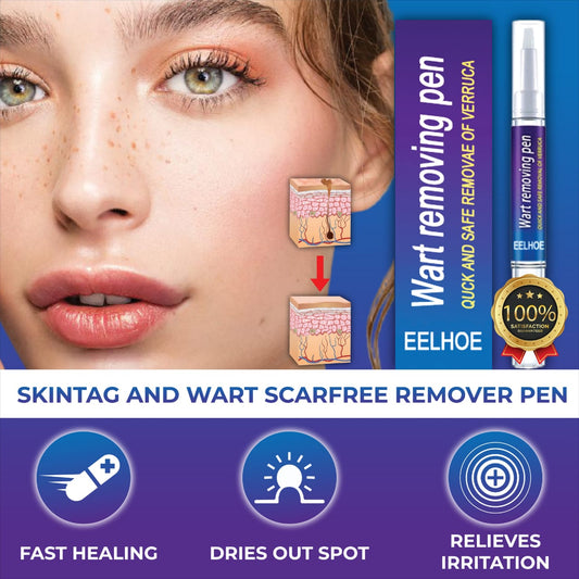 Afraz Smart Wart Remover Gel Pen – Powerful Fast-Acting Skin Treatment