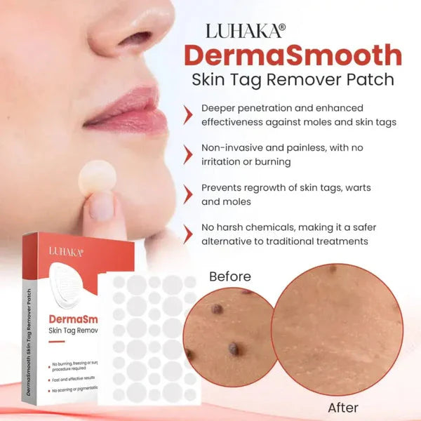 Afraz DermaSmooth Skin Tag Remover Patches – Fast, Safe & Painless Tag and Mole Removal