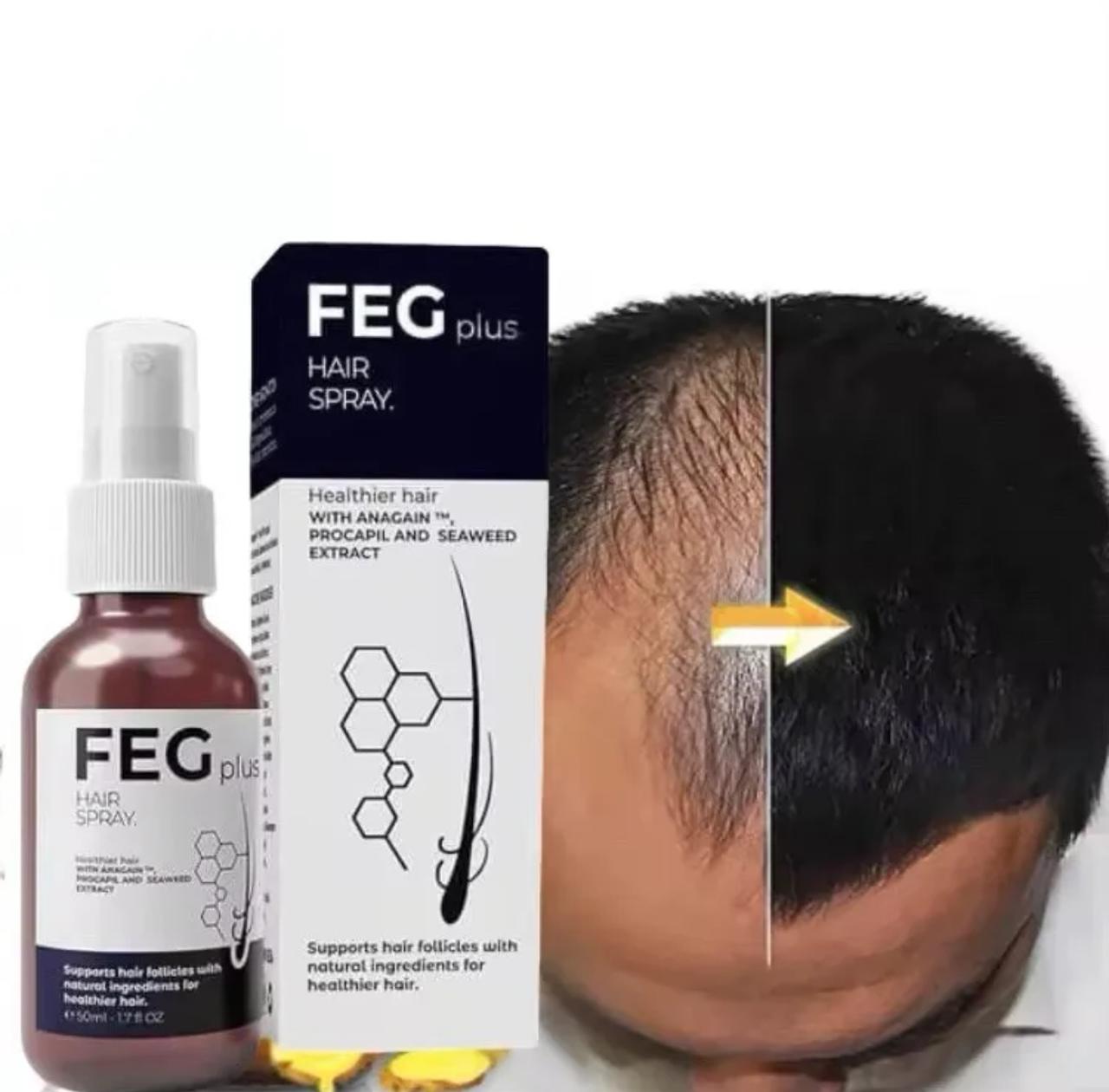 Afraz FEG PLUS Hair & Beard Regrowth Spray – Anti Hair Loss Formula