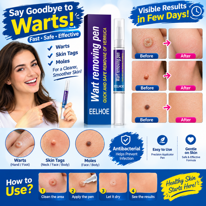 Afraz Smart Wart Remover Gel Pen – Powerful Fast-Acting Skin Treatment
