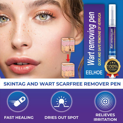 Afraz Smart Wart Remover Gel Pen – Powerful Fast-Acting Skin Treatment
